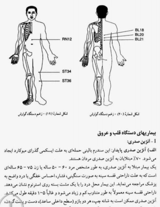 خوداموز درمان بیماریها  با بادکش،